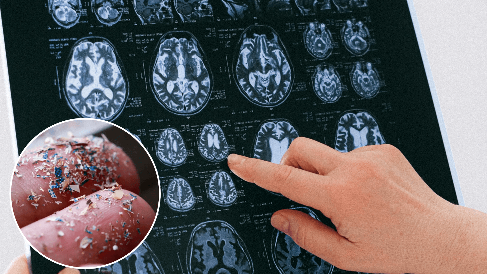 Microplásticos: Costa Rica debe actuar ante amenaza cerebral